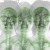 Supergrass • Supergrass (2CD)